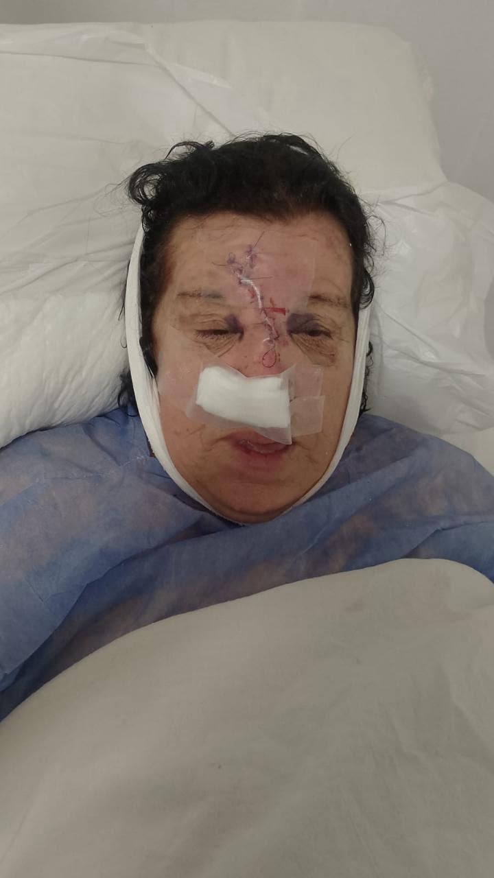 Intento de robo con extrema violencia a una mujer mayor en Malvinas Argentinas: aún no pudo realizar la denuncia por permanecer internada